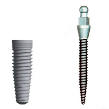A size comparison showing that mini implants have a much smaller diameter than traditional dental implants.