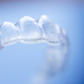 Closeup photo of an Invisalign aligner, part of an orthodontic smile makeover.