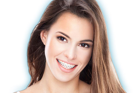 A young woman smiles beautifully with braces placed by her orthodontist.