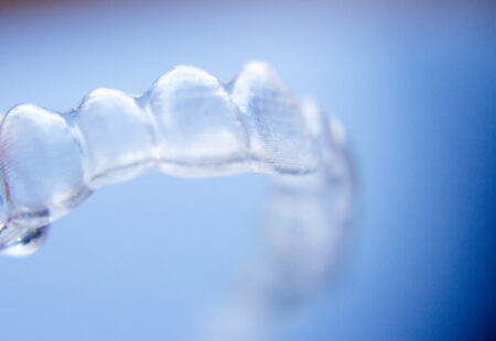 An image of Invisalign aligners